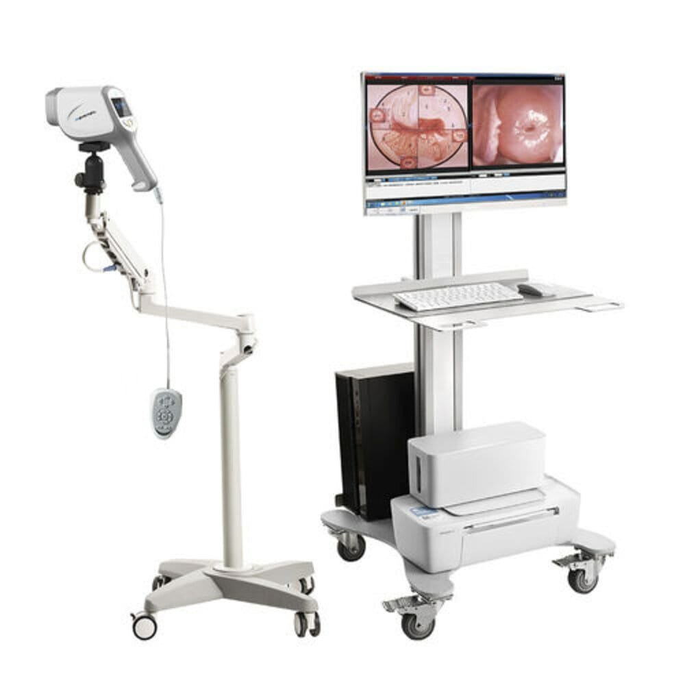 Buy Video Colposcope In Nigeria