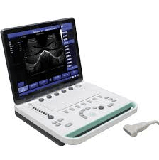 Best Ultrasound Scanner For Clinic Nigeria
