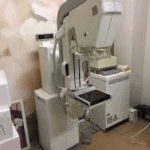 Best Mammography Machine For Hospitals Nigeria
