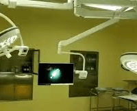 Spirometer Near Me Nigeria
