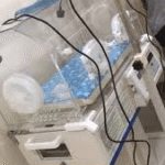 Phototherapy Machine Price In Lagos