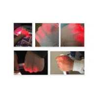 Fetal Doppler Price In Nigeria