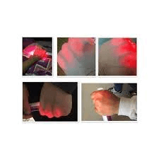 Fetal Doppler Price In Nigeria