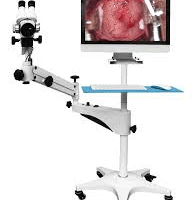 Digital Colposcope Near Me In Nigeria