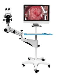 Digital Colposcope Near Me In Nigeria