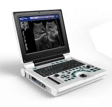 Ultrasound Machine Near Me Nigeria