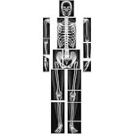 X-Ray Film Near Me Nigeria