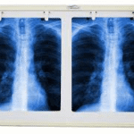 When searching for Ultrasound Gel Price In Lagos, healthcare providers focus on value, quality, and daily usability. This product supports clear imaging, smooth probe movement, and patient comfort during routine and advanced ultrasound procedures. Clinics require gel that performs well in busy environments while remaining cost effective. A balanced texture helps reduce air gaps and improves signal transmission during scans. Medical teams appreciate predictable flow, easy handling, and clean removal after use. These features help professionals deliver accurate results with confidence. Consistent Quality and Daily Performance This ultrasound gel delivers steady conductivity and even spread on skin surfaces. It supports clear imaging across different diagnostic needs and equipment types. The smooth texture allows controlled application, which reduces waste and saves time during procedures. Technicians maintain focus because the gel stays stable during scanning. In addition, easy cleanup supports faster room turnover. Clinics value reliable viscosity that works well in varied temperatures. The gel supports patient comfort and reduces friction during longer sessions. Staff experience fewer interruptions and smoother workflows. This consistency helps facilities plan usage and manage supplies efficiently. Practical Value for Medical Facilities Understanding Ultrasound Gel Price In Lagos helps hospitals balance budgets without compromising performance. This gel fits routine imaging needs in radiology, obstetrics, cardiology, and general practice. It supports hygienic standards and works well with common clinical protocols. Storage remains simple, and controlled dispensing improves inventory management. Healthcare teams benefit from dependable daily results and improved operational flow. Clear labeling aids quick identification in urgent cases. The gel supports accurate diagnostics and professional confidence. Facilities gain a practical solution that meets performance expectations and cost considerations. Reliable use strengthens patient trust and supports quality care delivery across Lagos medical centers.